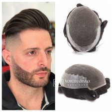 Mens Hair Replacement System