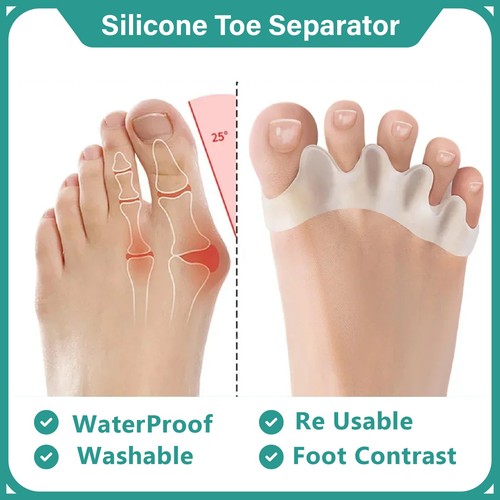 2pcs silicone toe - silicone, separator