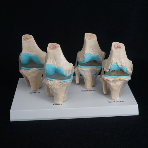 Anatomical human degenerative - anatomical,