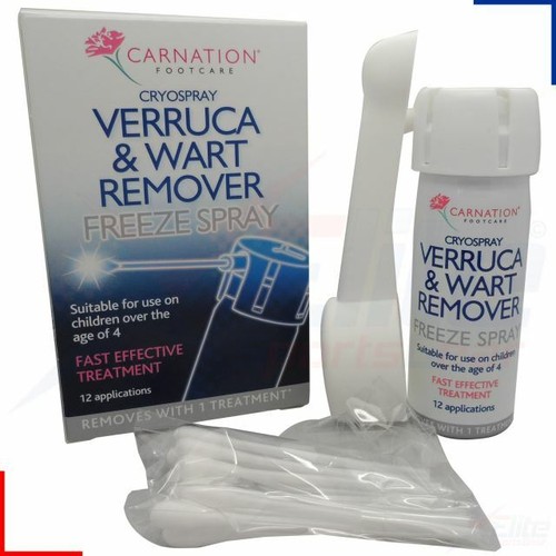 Carnation cryospray verruca - cryospray,