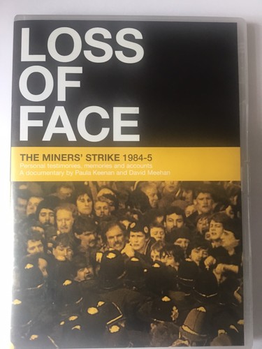 Loss face the miners - loss, of
