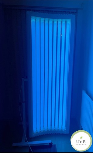 Uvb light therapy unit lamp - uvb,