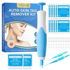 Skin tag remover kit - remover, face
