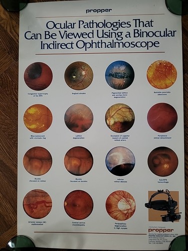 Ocular pathologies medical - ocular,