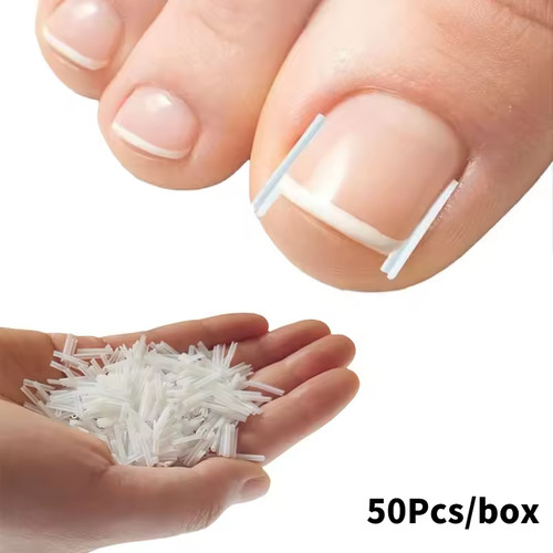 50pcs ingrown toenail - 50pcs,