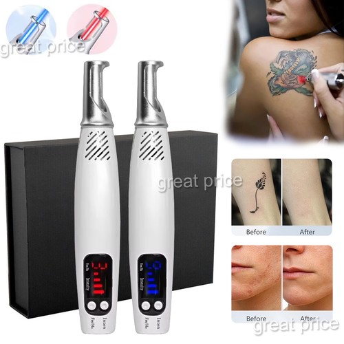 Handheld picosecond laser pen - picosecond,