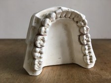 Vintage French Plaster Cast Human Dentures Model Brocante Salvage France