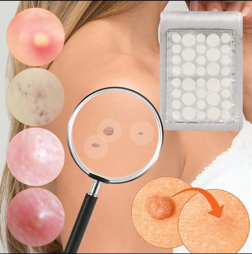 72pcs skin tag - skin, patches