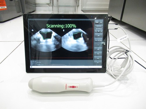 Vitacon vitascan portable - vitascan,