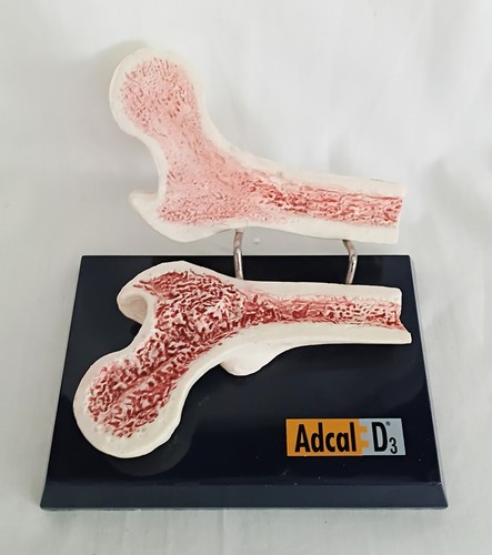 Vintage adcal bone marrow - adcal,