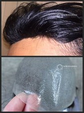 Toupee for Men Thin Skin Hair