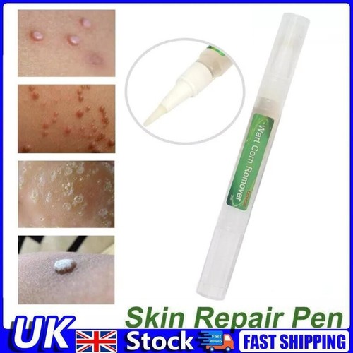 Skin tag removal treatment - skin,