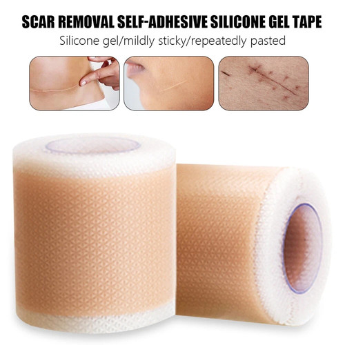 Scar removal silicone - removal, gel