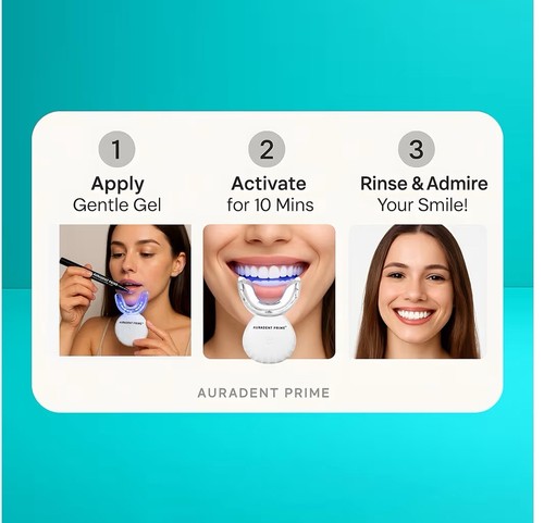 Teeth whitening kit 32 - -,