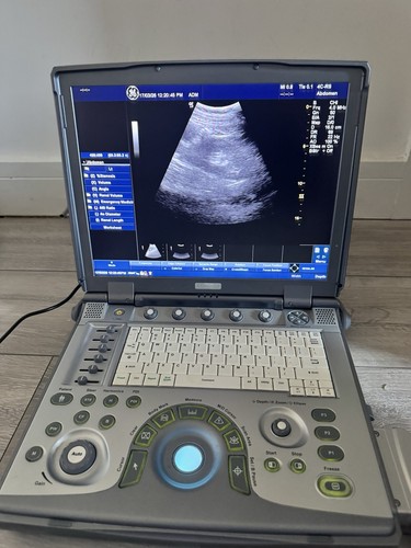 Logiq ultrasound scanner - ultrasound,