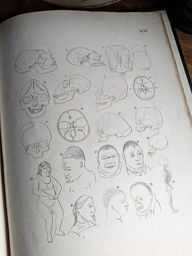 1865 the malformations man - of,