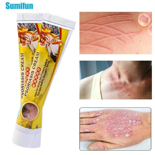 20g new tiger balm - 20g,
