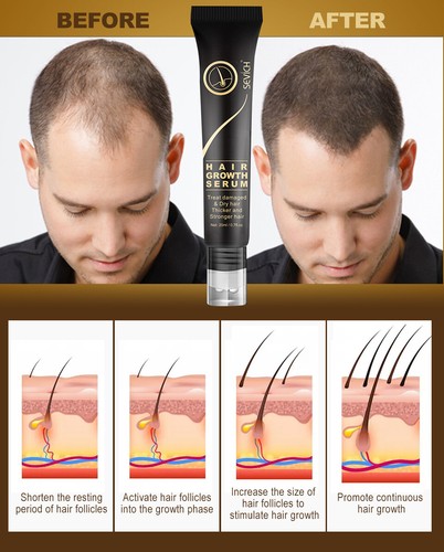 Ginger fast hair growth serum - growth,