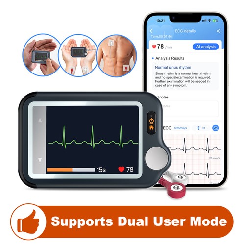 Checkme personal mobile ekg - checkme,