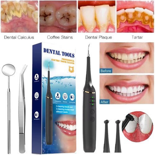 Electric ultrasonic dental - electric,