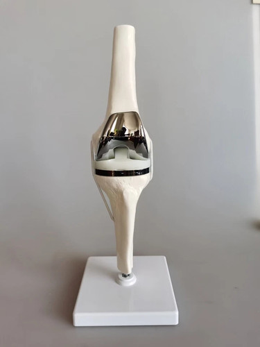Artificial knee joint - knee,