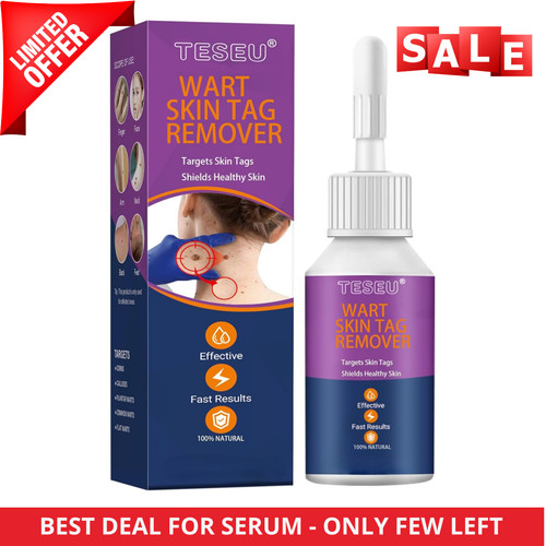 Strong skin tag remover - strong,