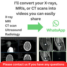 If You Are Using Anagel 250ml Fetal Doppler Ultrasound Transmission Gel 