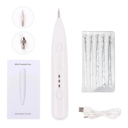 Laser plasma pen mole - pen, removal