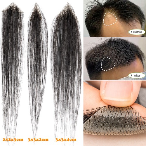Bald spot hair - bald, toupee