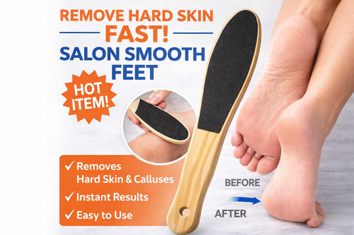 Hard skin remover foot file - skin,