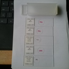 5 SLIDES BY PHILIP HARRIS IN