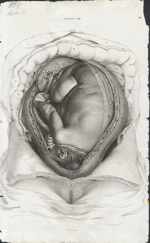 Open uterus from the - from,