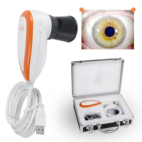 Pro usb iriscope iris - pro,