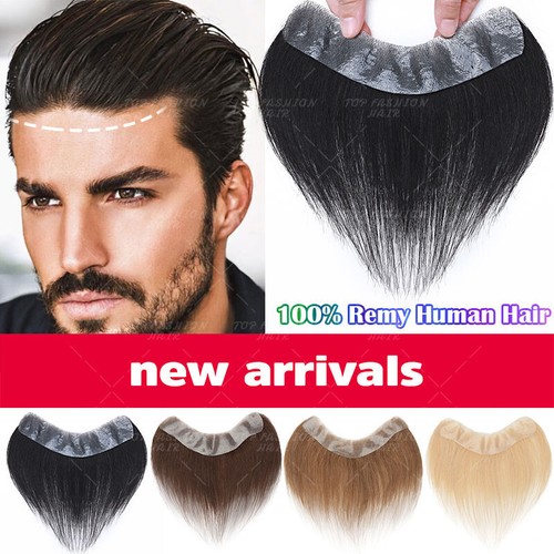 Replacement system mens - mens, toupee