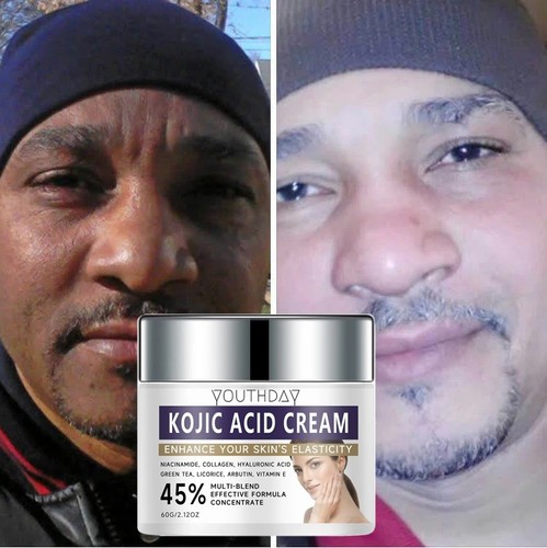 Kojic acid skin - acid,