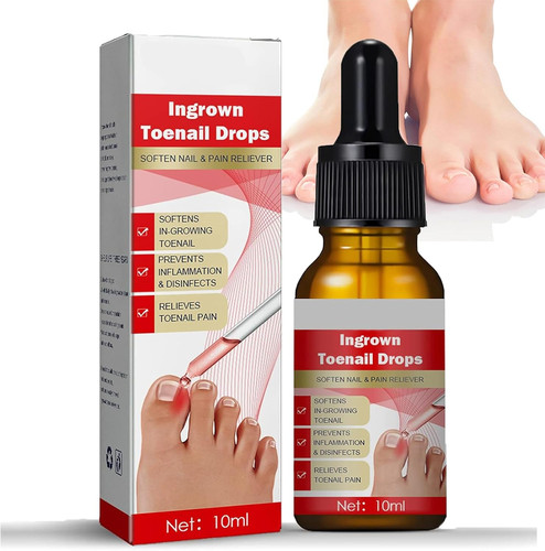 Ingrown toenail treatment - toenail,