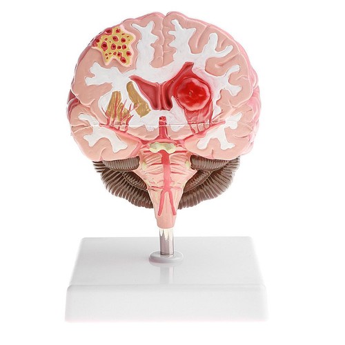 Anatomical human brain - anatomical,
