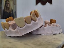 1960s Dental Teeth/Jaw