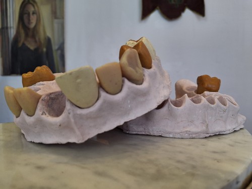 1960s dental teeth - dental, teeth/jaw