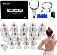 Cupping Set, Cupping Therapy