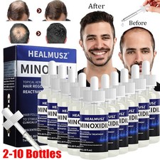Minoxidil topical solution - topical,