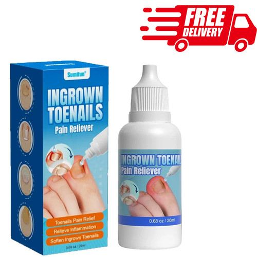 Ingrown toenail - ingrown,