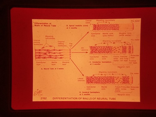 Xap03 35mm slide photo vintage - slide,