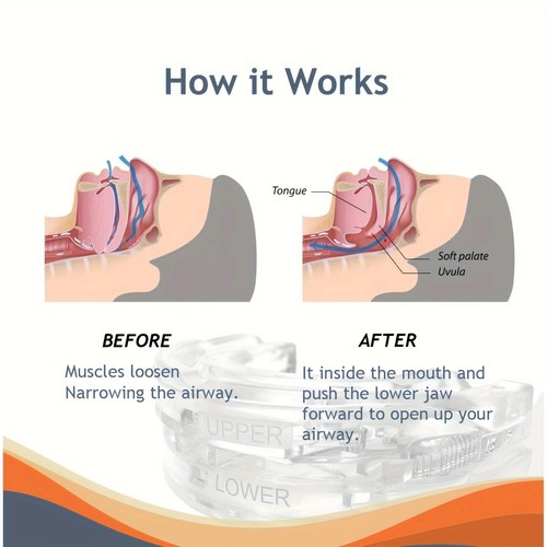 Genuine anti snoring - anti,
