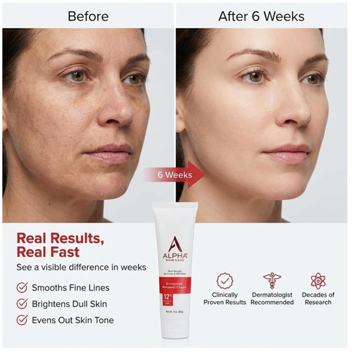 Skin renewal cream reduces - skin, cream,