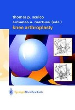 Knee Arthroplasty by MD