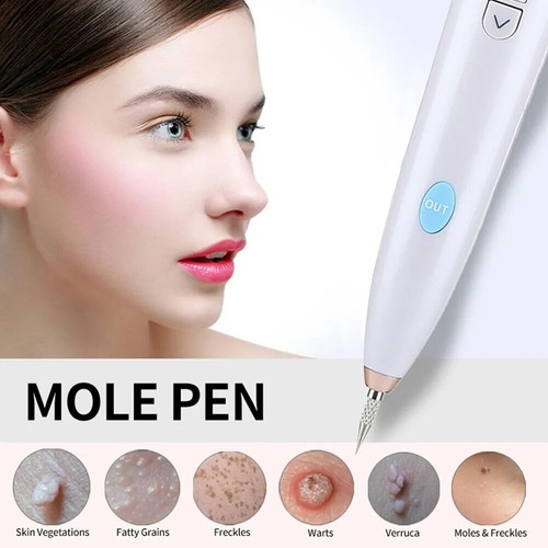 Laser plasma pen - pen, mole