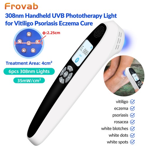 308nm uvb phototherapy device - phototherapy,