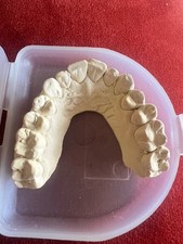 Dental Teeth Plastercast