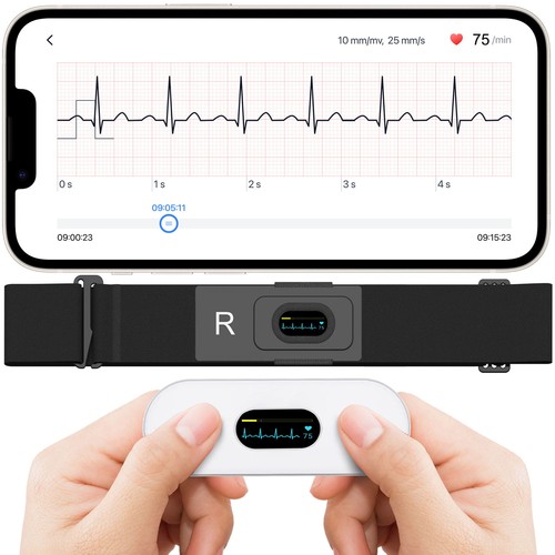 Checkme er2 mobile - checkme, ecg